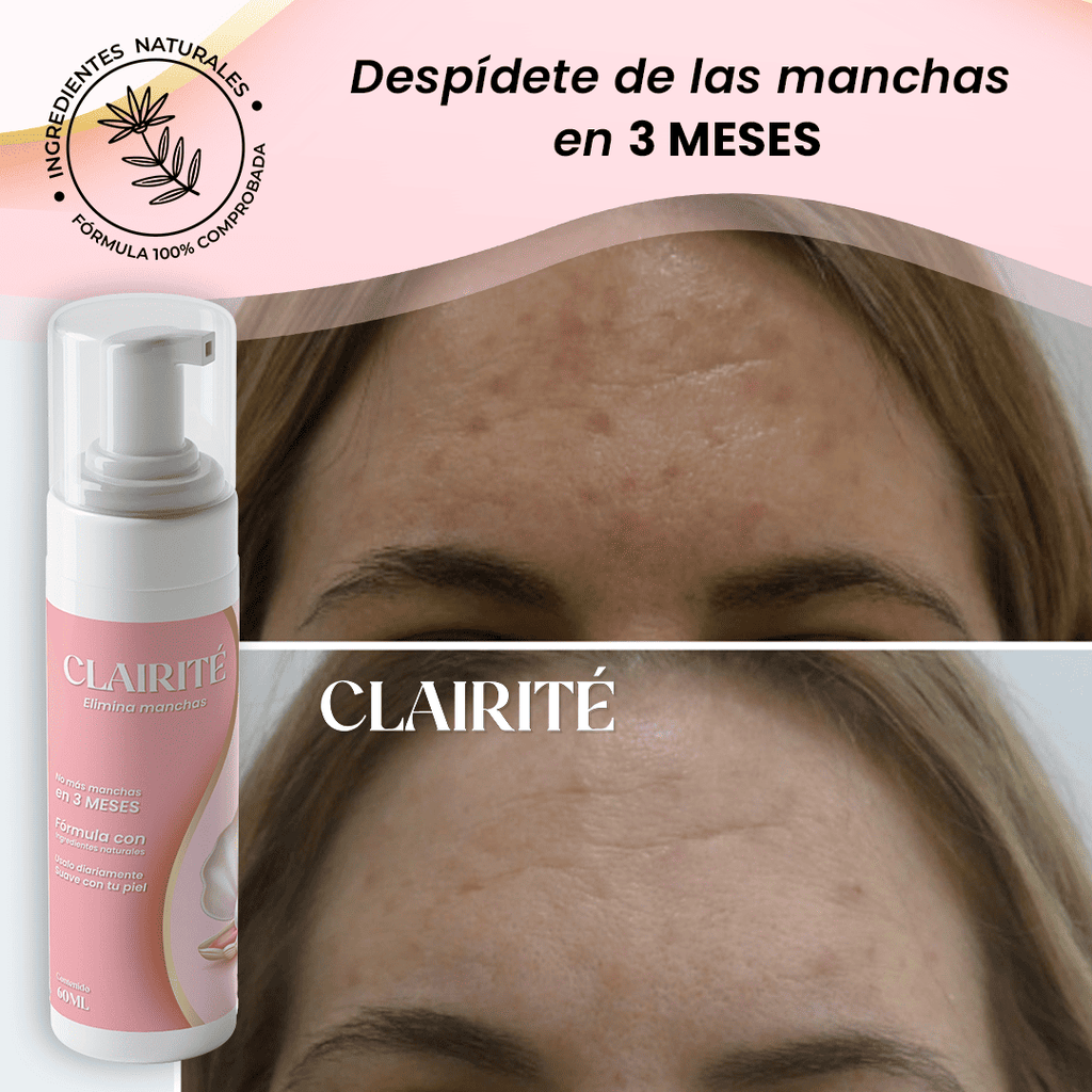 GlowFade™ Despigmentante aclarador