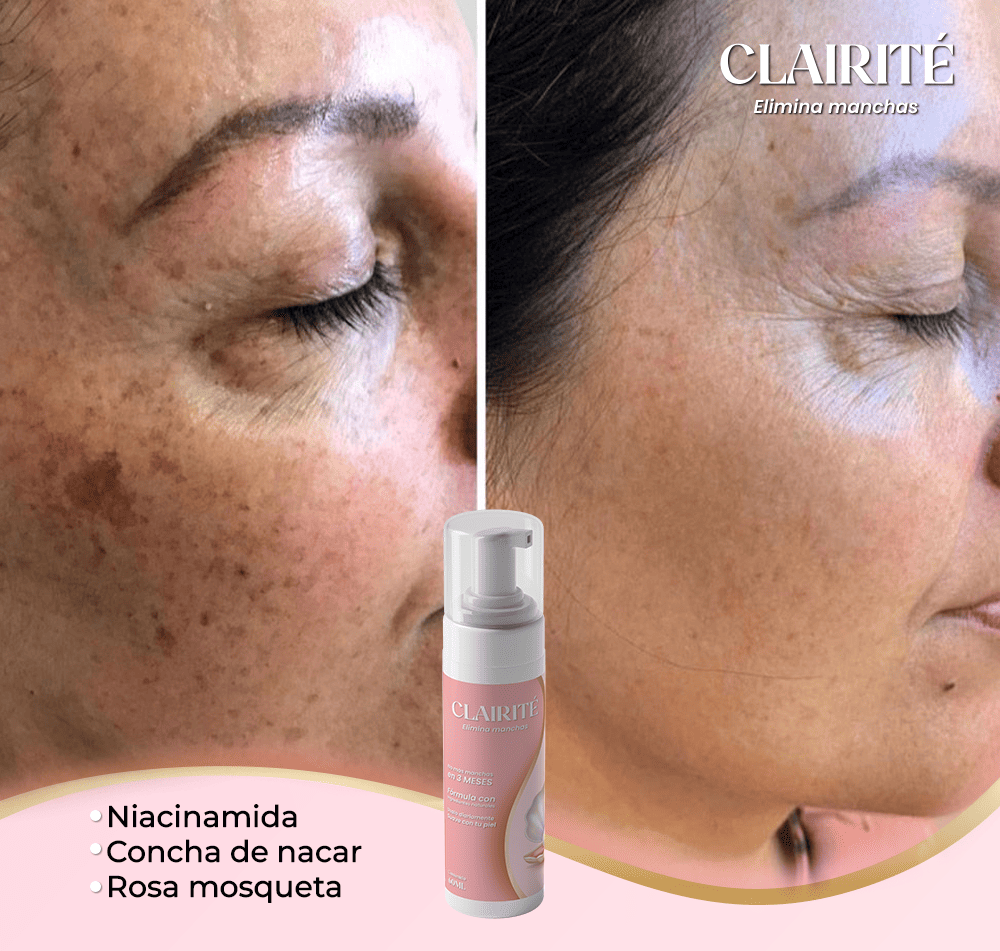 GlowFade™ Despigmentante aclarador